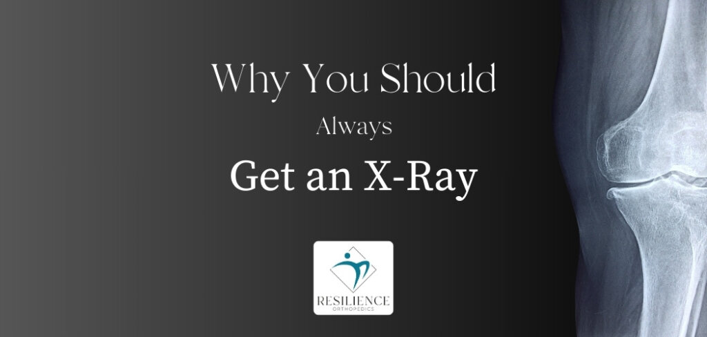 Always Get an X-ray