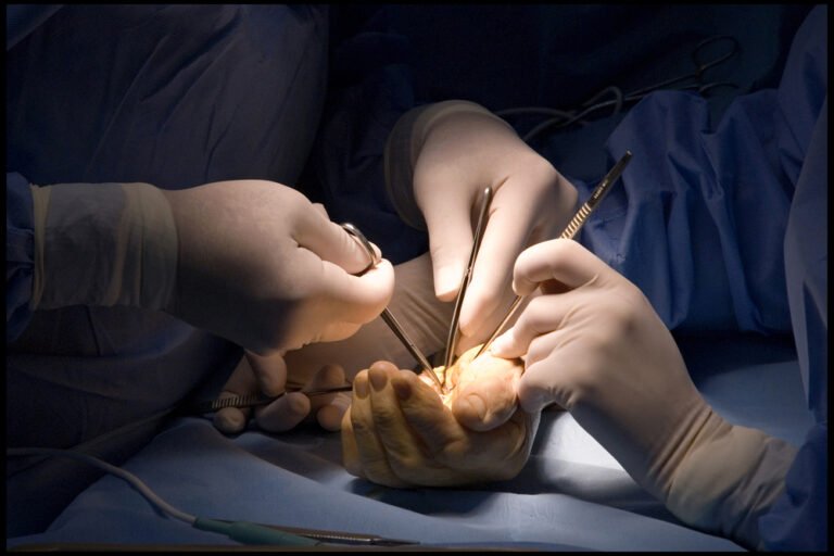 Hand surgery in San Jose