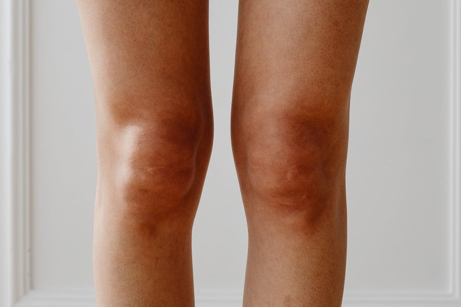 Les symptômes de la douleur au genou peuvent être graves.