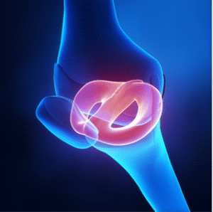 meniscus knee joint