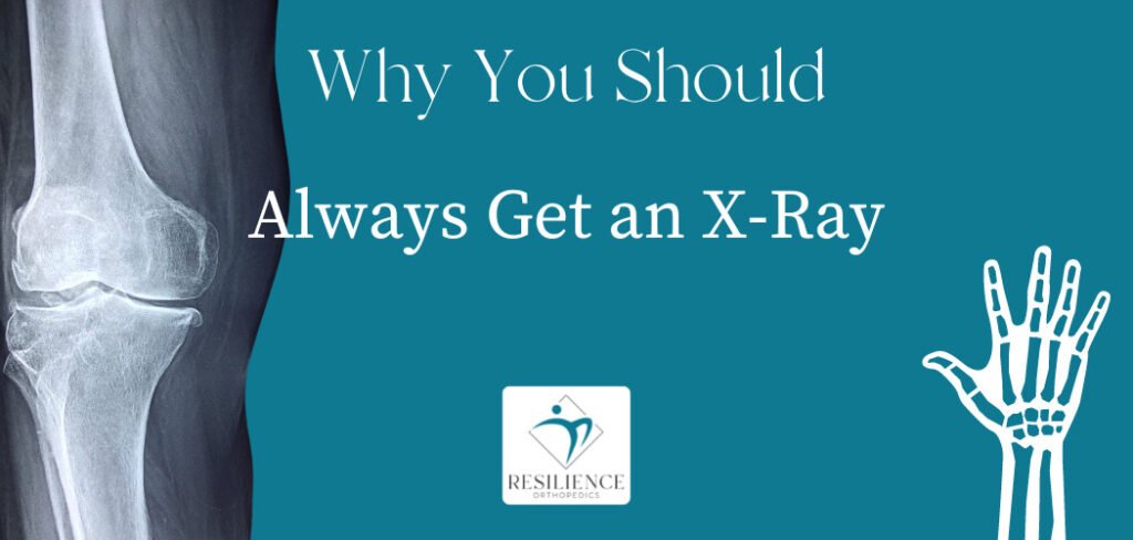 why you should always get an xray for joint pain