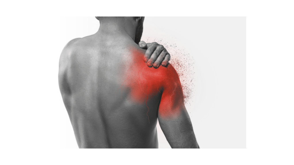 Frozen Shoulder can give you pain and stiffness