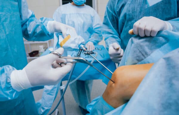Knee arthroscopy surgery in San Jose