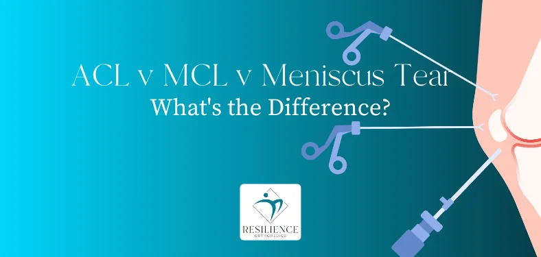 Quick Guide for MCL Sprains – ACL Strong