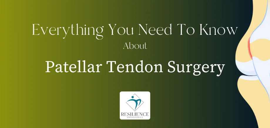 Everything You Need To Know About Patellar Tendon Surgery