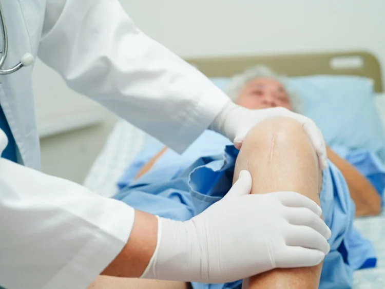 doctor examining patient with knee replacement