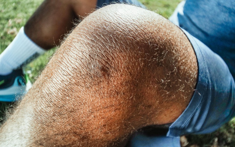 man with bruised knee