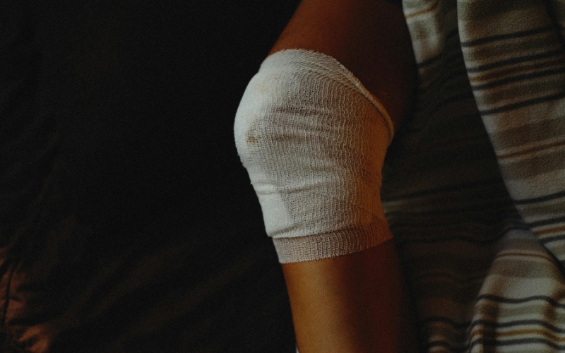 woman with knee bandage, bruising, and dressing