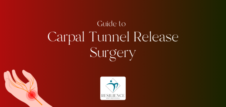 Guide to Carpal Tunnel Release Surgery