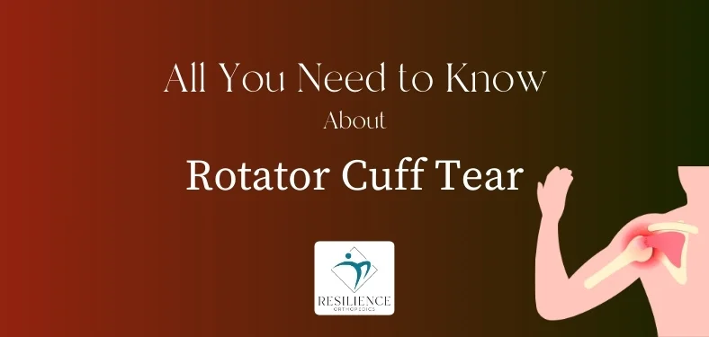 Guide to Rotator Cuff Tear