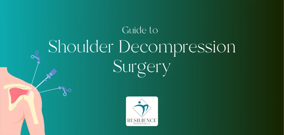 Guide to Subacromial Decompression Surgery