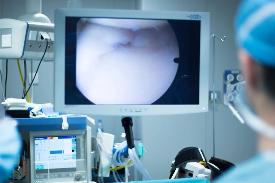 view of arthroscopy on screen