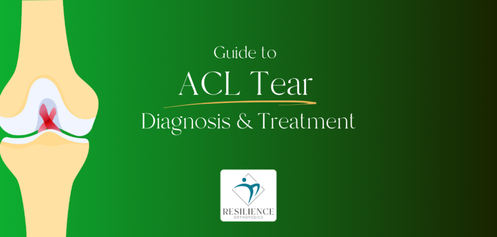 Guide to ACL tear treatment