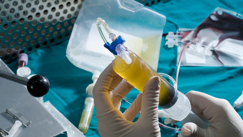 doctor with a vial of stem cells