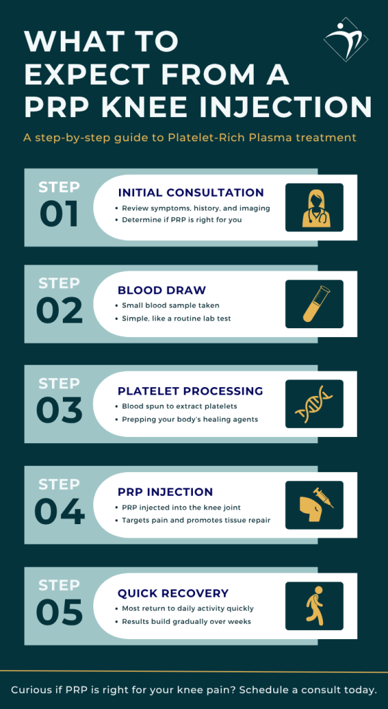Illustration of what patients can expect from PRP knee injections.