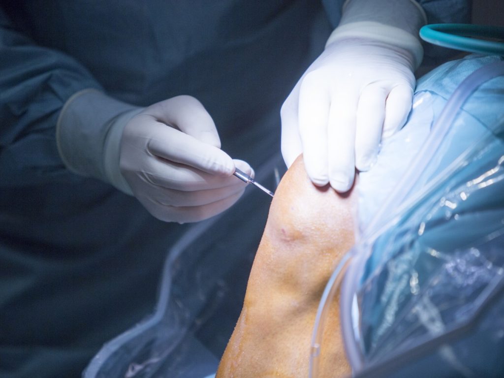 Surgeon performing knee surgery on patient