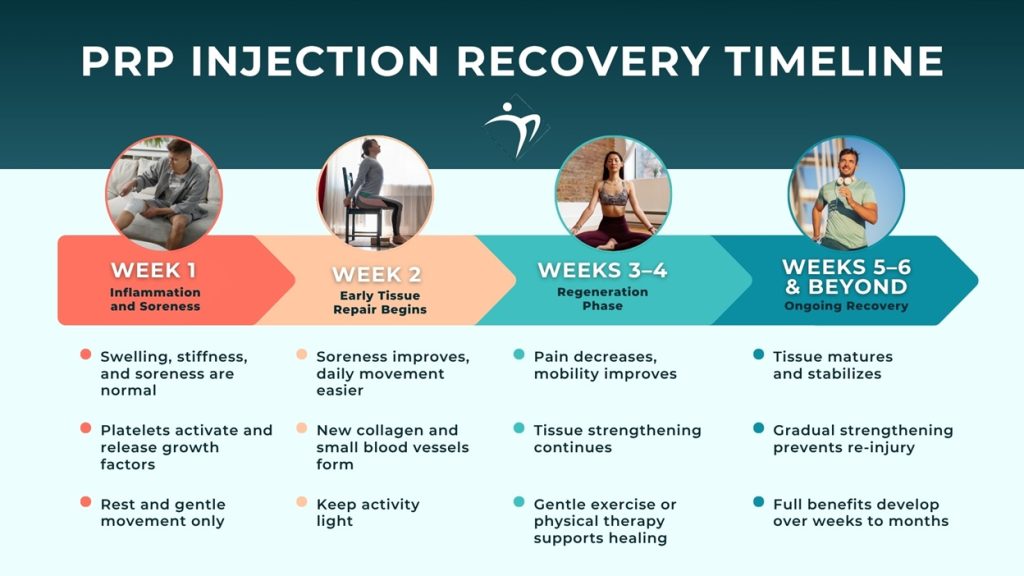 PRP Recovery Timeline